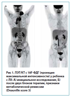 Особенности использования методов ядерной медицины в педиатрии