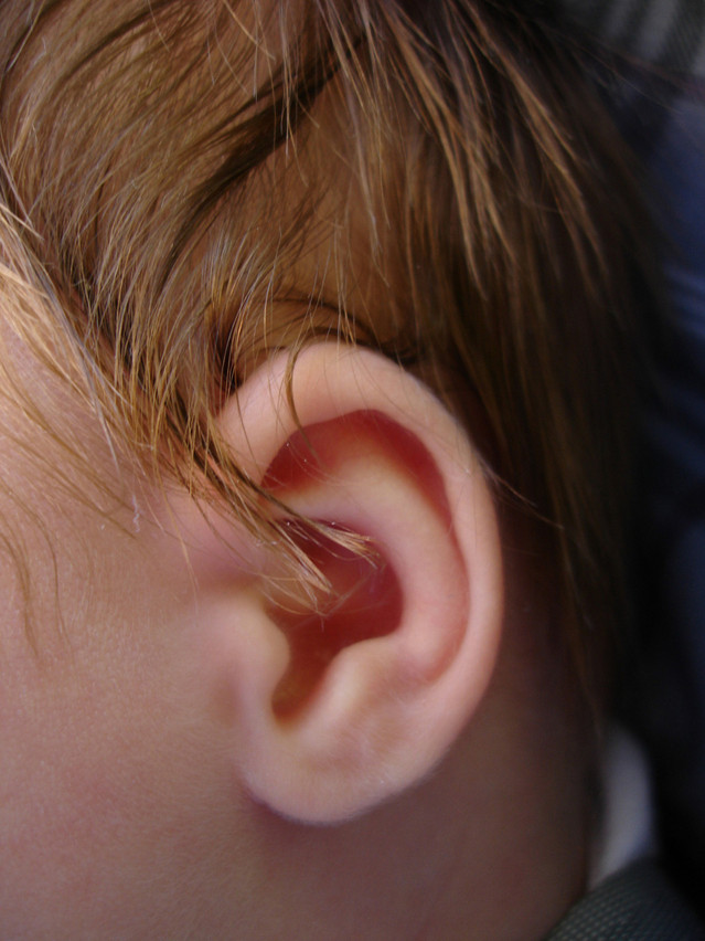 Стволовые клетки восстановят слух без риска образования опухоли