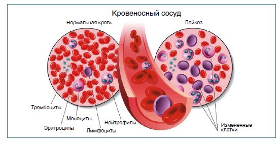 От инжиниринга трансплантата до инжиниринга лимфоцитов