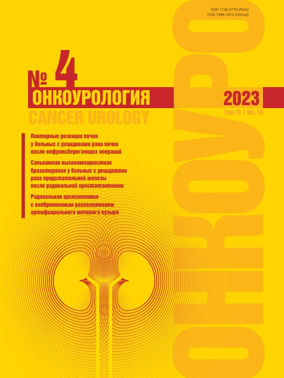 Онкоурология № 4, 2023 год № 4, 2023 год