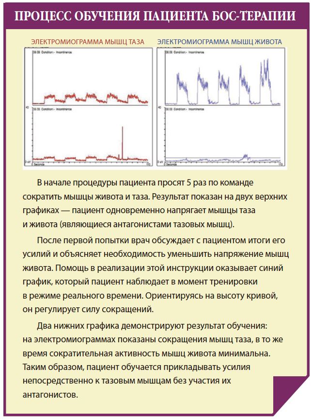 ПРОЦЕСС ОБУЧЕНИЯ ПАЦИЕНТА БОС-ТЕРАПИИ