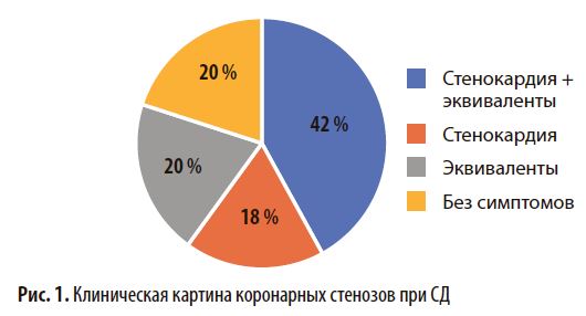 Клиническая картина коронарных стенозов при СД