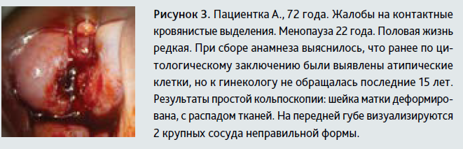 АГС3-4-22.PNG