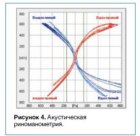 Рисунок 4. Акустическаяриноманометрия.