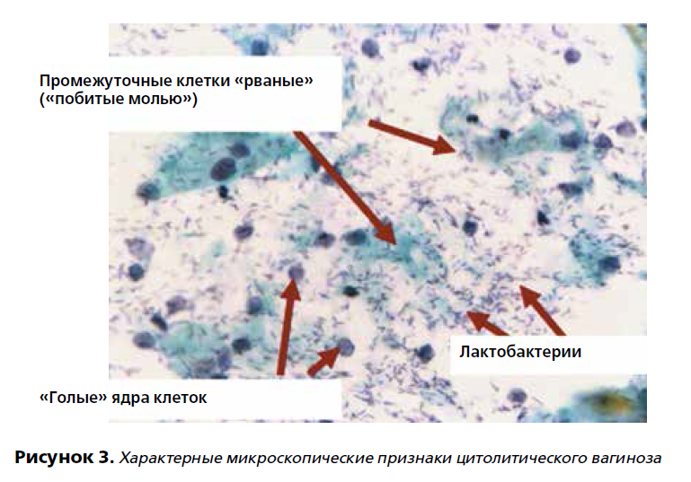 Снимок424.PNG