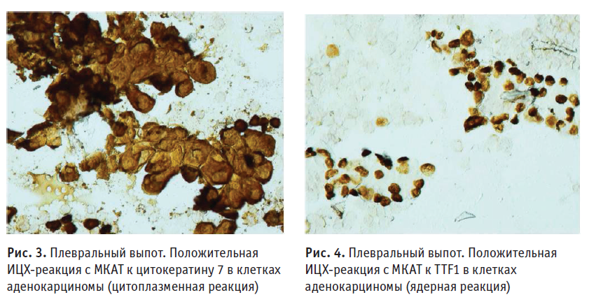 СнимокОС11918.PNG